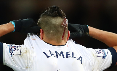 lamela